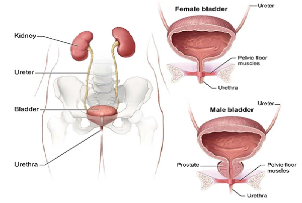 Ureteric Reimplantation