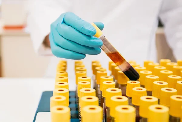 lab Test